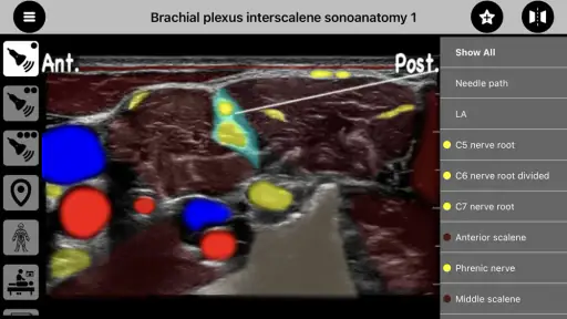 AnSo Anaesthesia Sonoanatomy