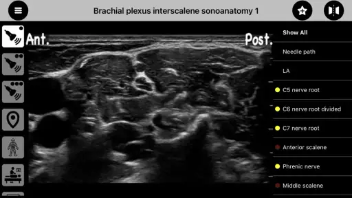AnSo Anaesthesia Sonoanatomy