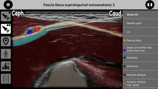 AnSo Anaesthesia Sonoanatomy