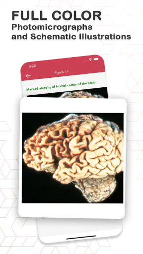 Board Review Series-Pathology