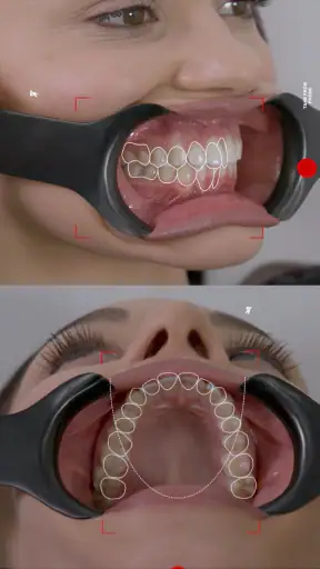 Dental Shooting