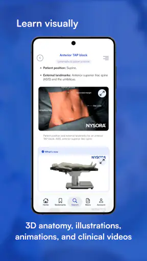 NYSORA Nerve Blocks