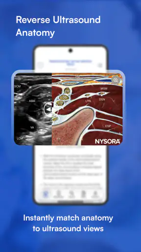 NYSORA Nerve Blocks