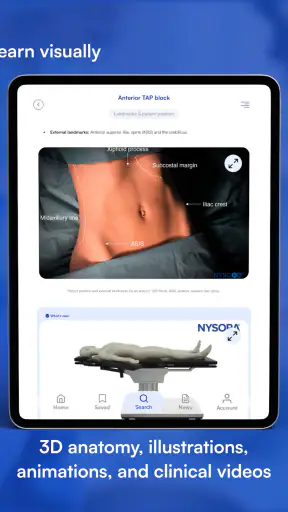 NYSORA Nerve Blocks