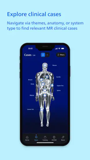 Philips MR Imaging