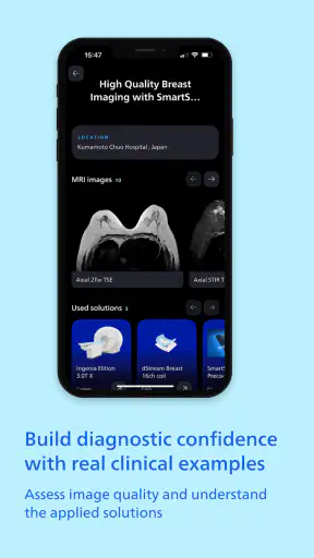Philips MR Imaging