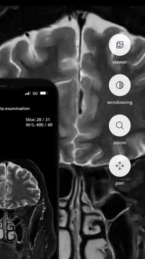 Philips MR Imaging
