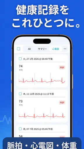 SmartBP - 血圧測定値を記録|シンプルな高血圧管理