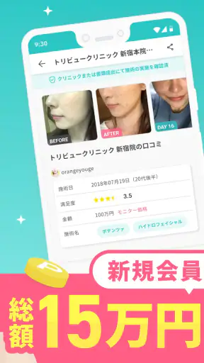 トリビュー(美容 医療の口コミ予約アプリ)