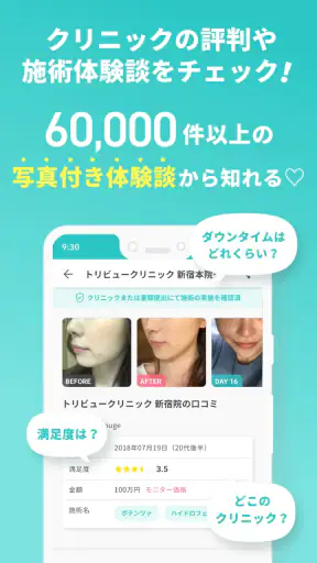 トリビュー(美容 医療の口コミ予約アプリ)