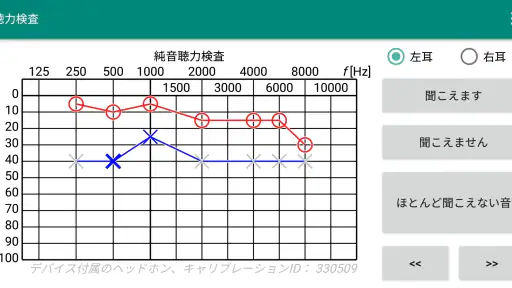 聴力検査