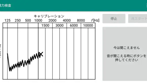 聴力検査