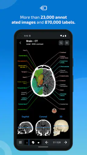IMAIOS e-Anatomy