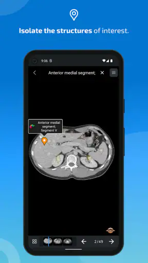 IMAIOS e-Anatomy