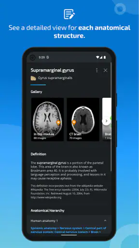 IMAIOS e-Anatomy